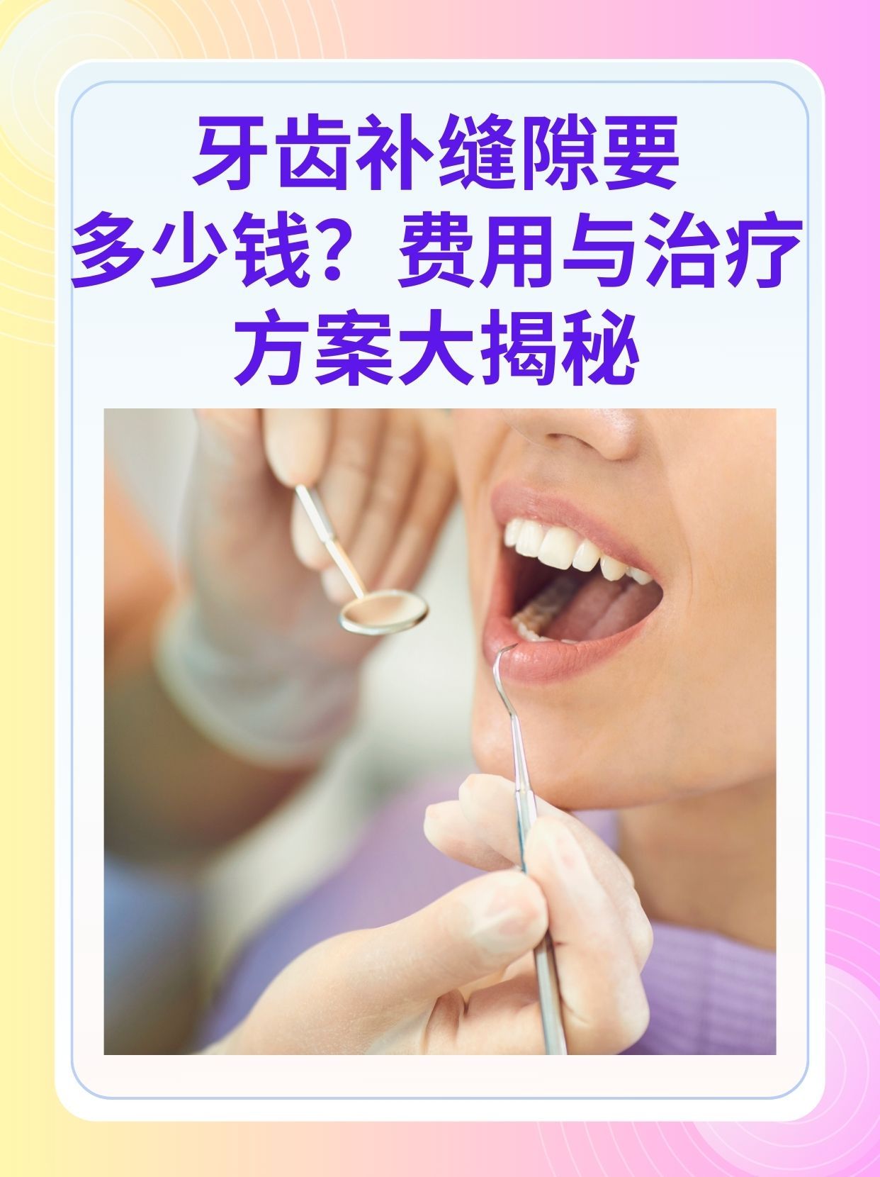 商丘补牙医保可以报销吗(补牙医保可以报销吗 哪些可以报销呢)